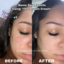 Load image into Gallery viewer, “The Dream Cream” Face &amp; Body Butter (for eczema/psoriasis and acne)